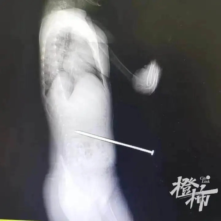 罐取暖使用不当身亡露营小心这些安全隐患pg电子试玩入口新闻多一度丨露营者瓦斯(图5) 罐取暖使用不当身亡露营小心这些安全隐患pg电子试玩入口新闻多一度丨露营者瓦斯(图5)